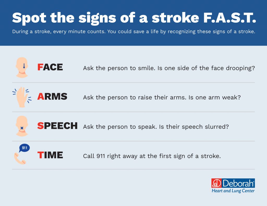 Graphic showing the signs of a stroke using the F.A.C.E. acronym.