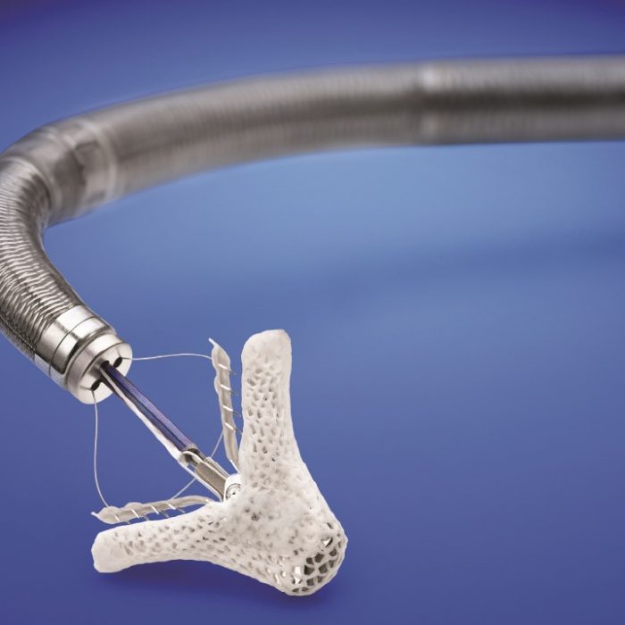 MitraClip